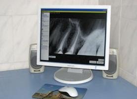 מהו צילום רנטגן לשיניים?