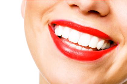 חיוך הוליווד, או איך להלבין את השיניים בבית